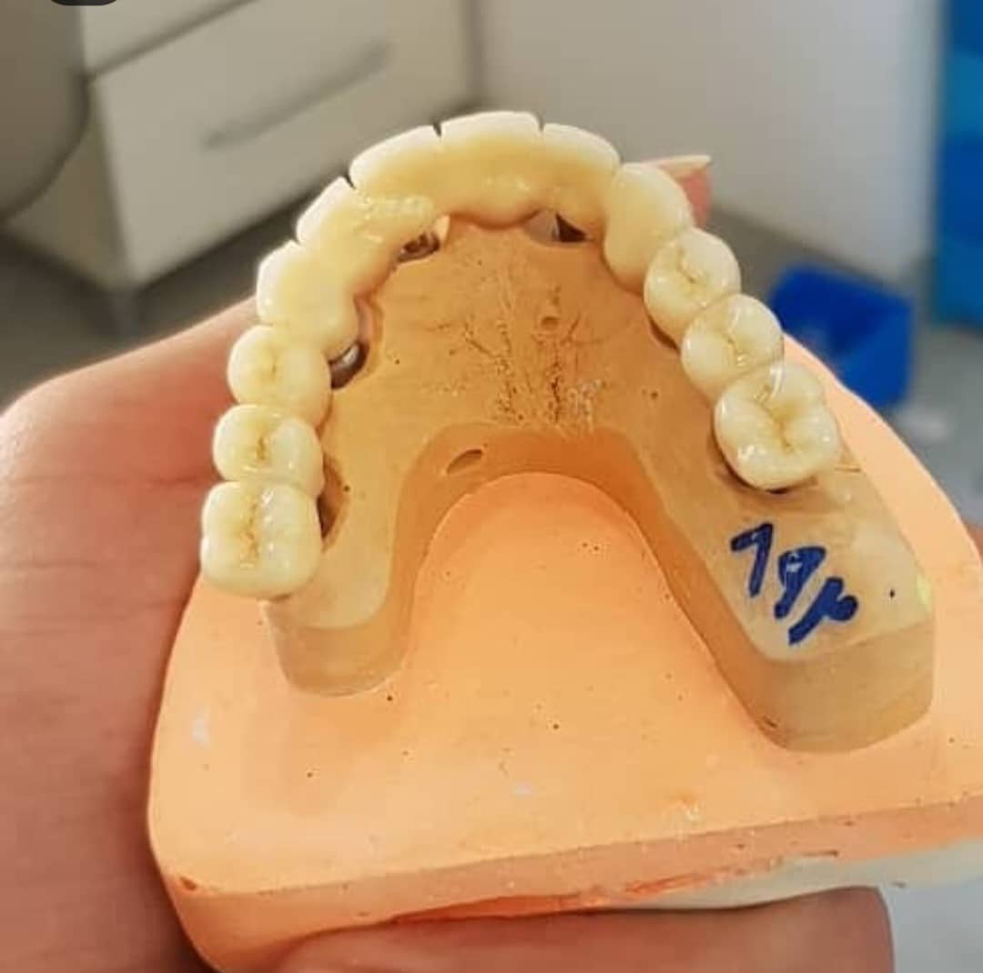 لابراتوار پروتزهای دندانی آرمان سلامت در بوکان