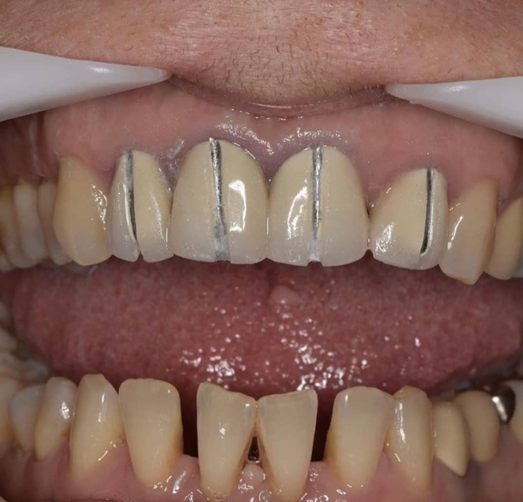 لابراتوار پروتزهای دندانی آرمان سلامت در بوکان