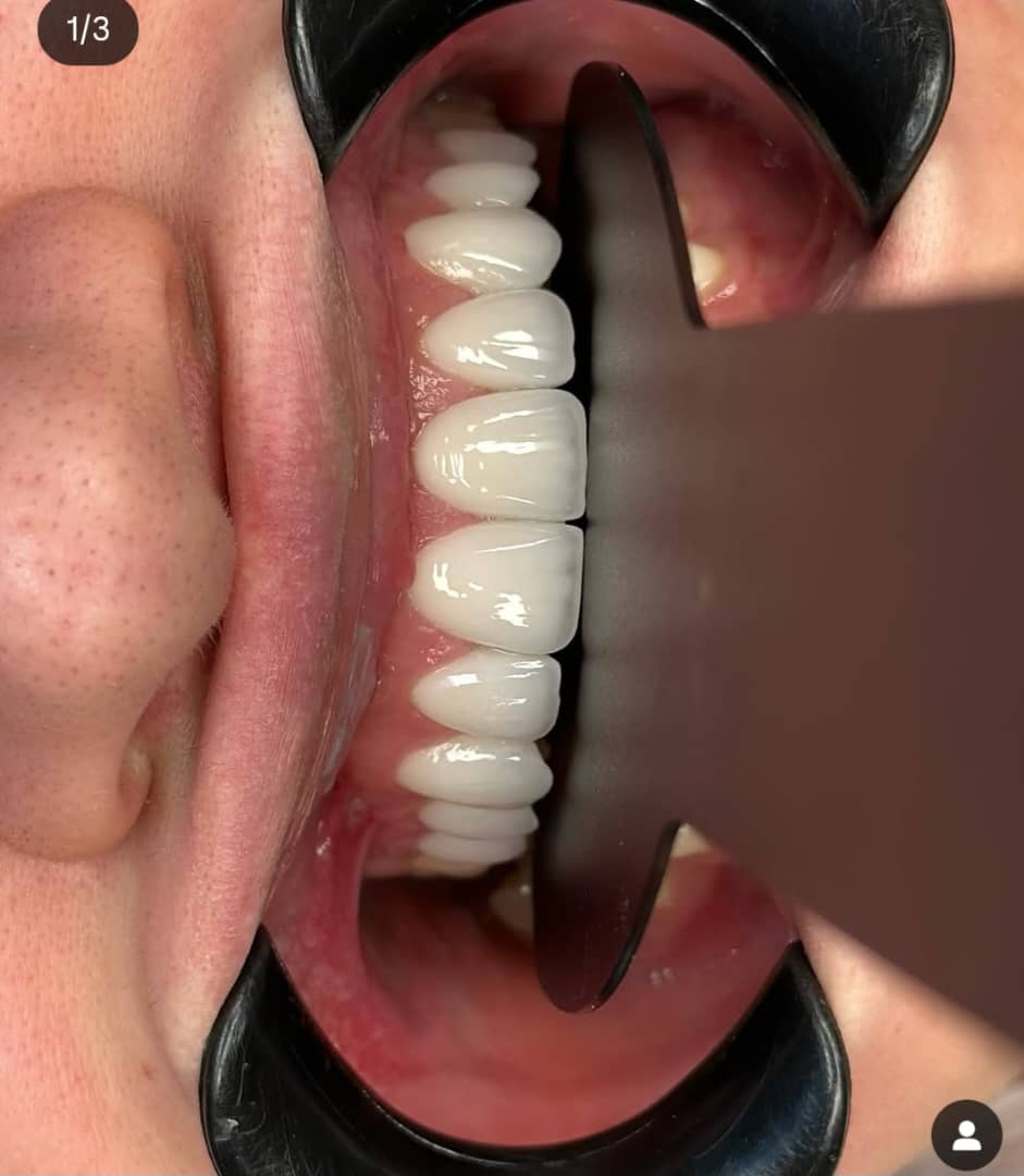 لابراتوار پروتزهای دندانی آرمان سلامت در بوکان