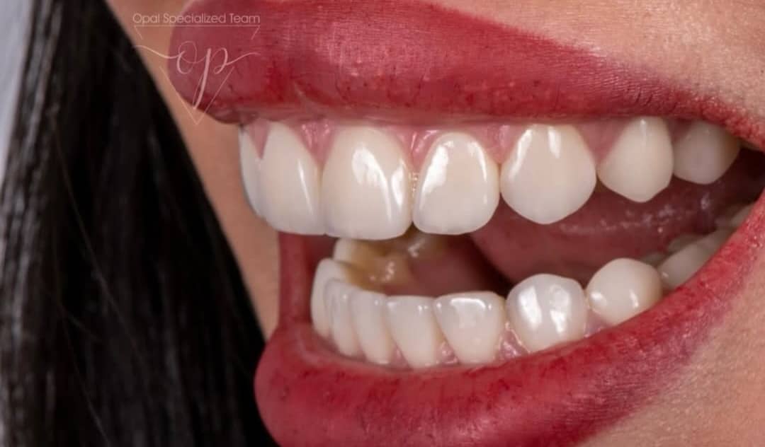 لابراتوار پروتزهای دندانی آرمان سلامت در بوکان