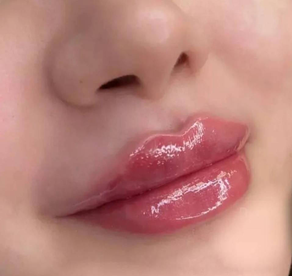 پارا کلینیک زیبایی دکتر حمید آزادی جراحی بلفاروپلاستی و لیپوساکشن در تبریز