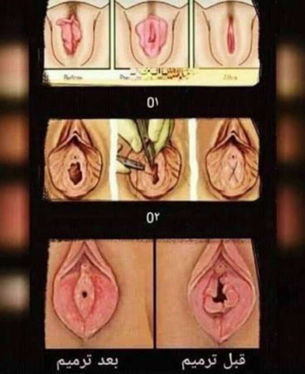 هایمنو پلاستی زینب بهاروند در خرم آباد