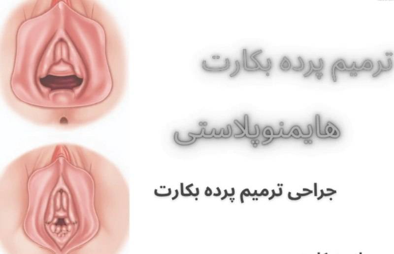 هایمنو پلاستی زینب بهاروند در خرم آباد