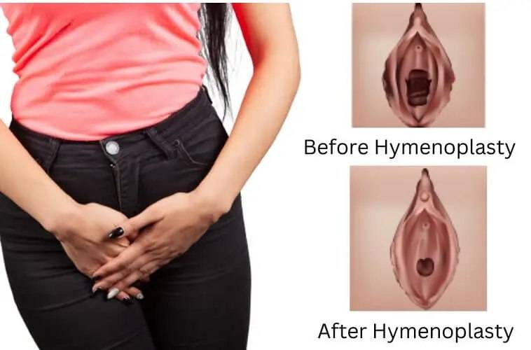 هایمنو پلاستی زینب بهاروند در خرم آباد