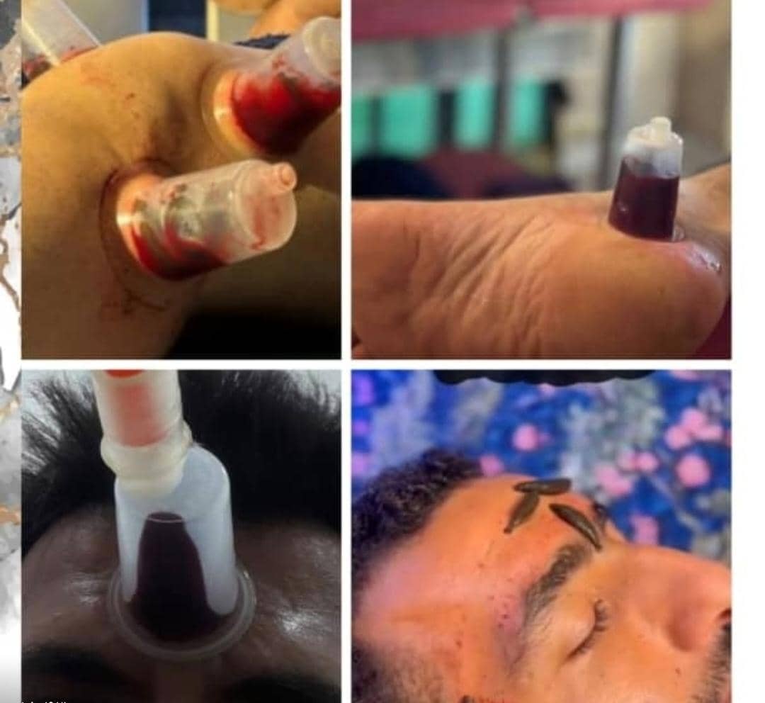 خدمات طب سنتی عامری در گلستان اهواز