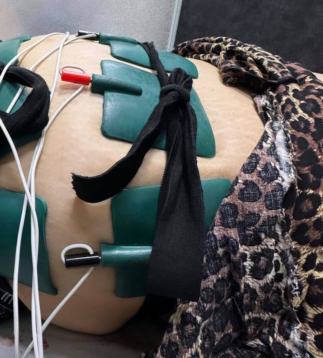 کلینیک تخصصی لیزر موهای زائد ماه لی در رشت