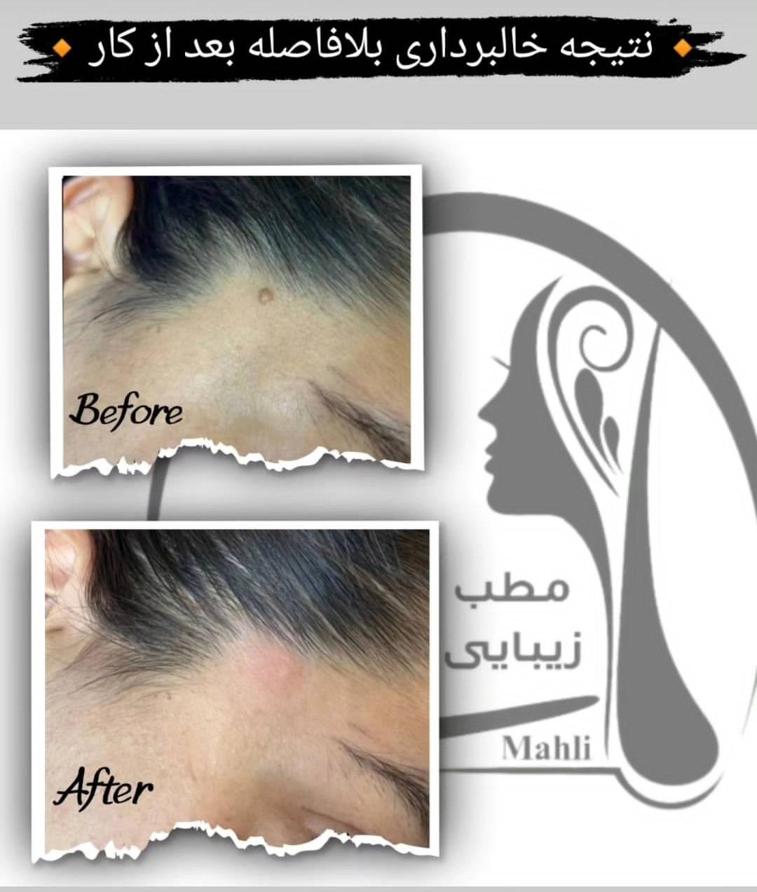 کلینیک تخصصی ماساژ ماه لی در رشت