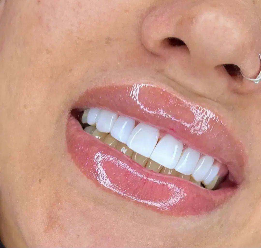 خدمات زیبایی دندان و کامپوزیت دنت الماس dent almas در اهواز