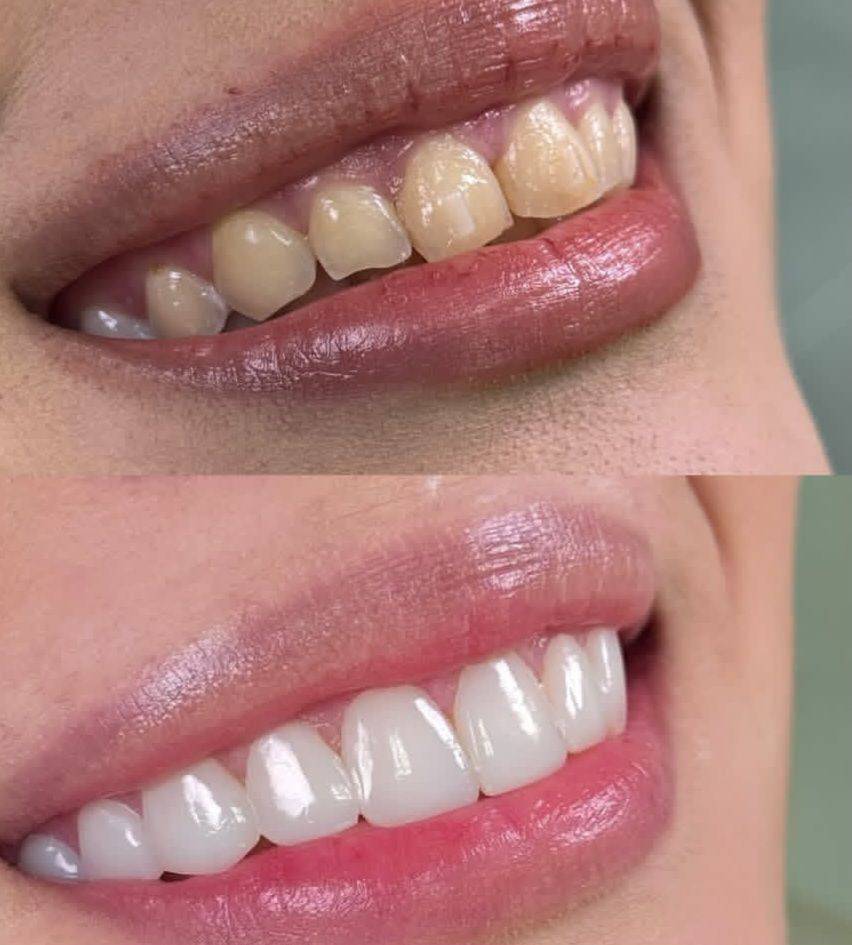 خدمات زیبایی دندان و کامپوزیت دنت الماس dent almas در اهواز