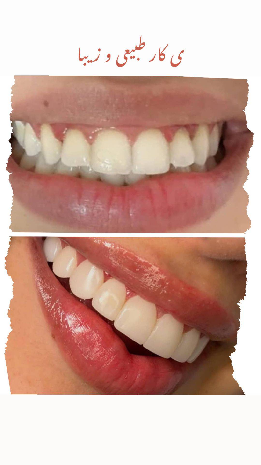 خدمات زیبایی دندان و کامپوزیت دنت الماس dent almas در اهواز