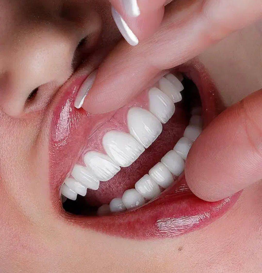 خدمات زیبایی دندان و کامپوزیت دنت الماس dent almas در اهواز