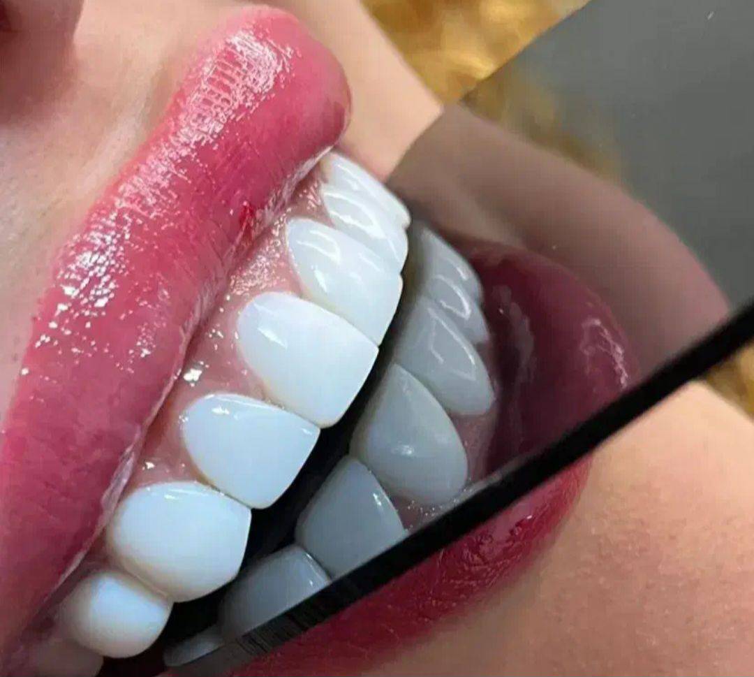 خدمات زیبایی دندان و کامپوزیت دنت الماس dent almas در اهواز