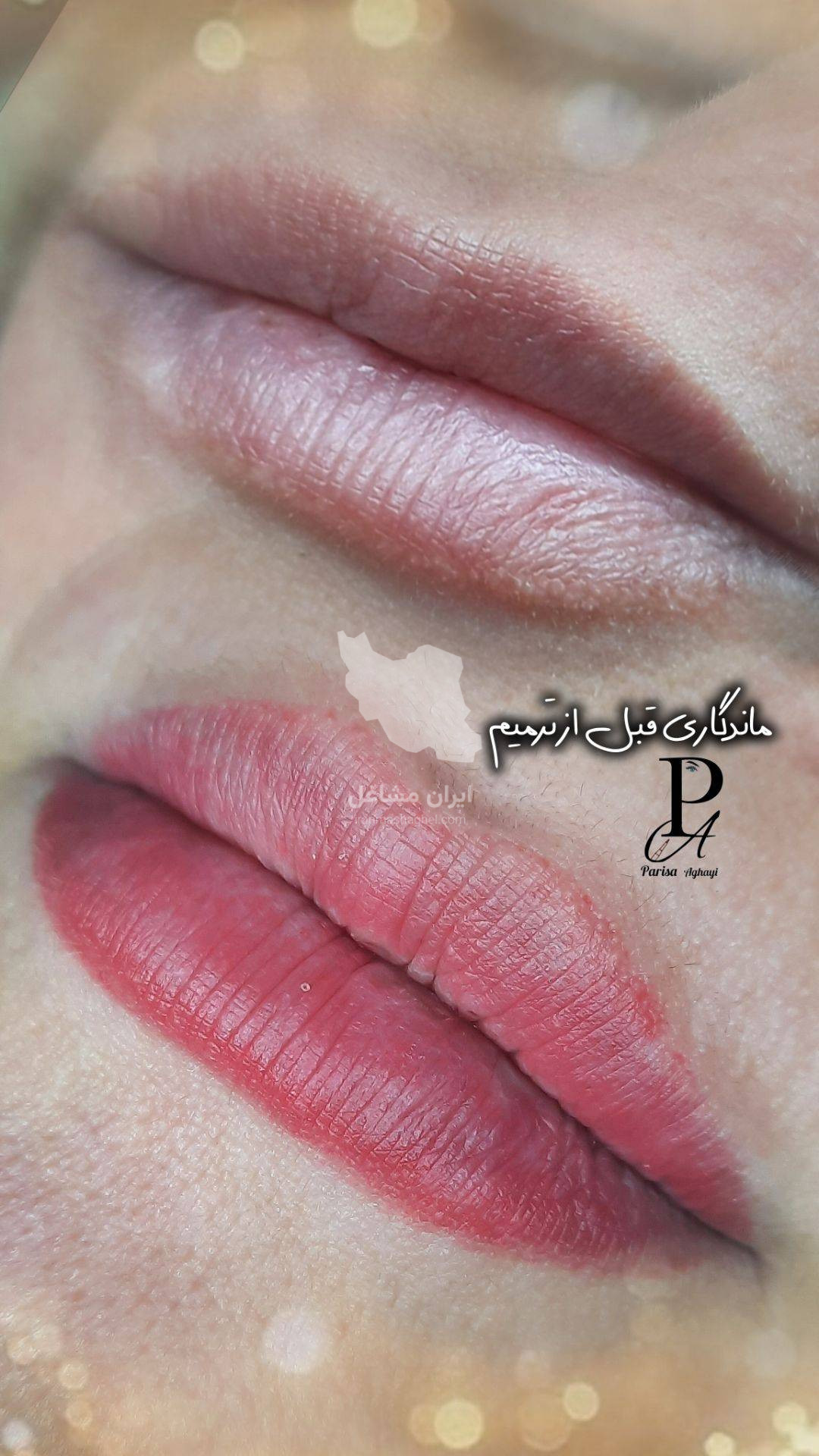ریموو تاتو و آرایش دائم و لایت مو پریسا آقایی در پرند تهران