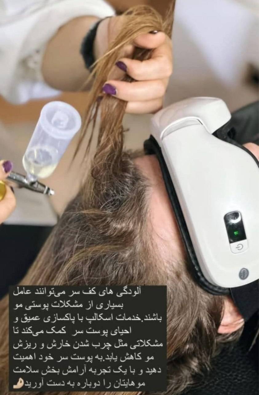 مرکز تخصصی اسکالپ و درمان کف سر محدثه محسنی در محمودآباد