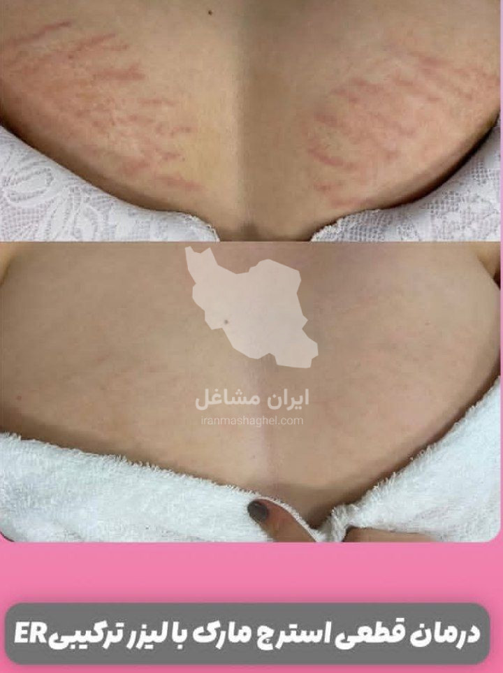 کلینیک لیزر فوتونا گندم در یزد