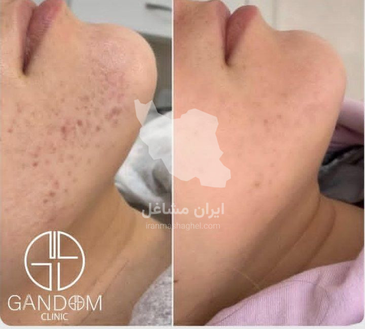 کلینیک تخصصی لیفتینگ و وایتینگ گندم در یزد