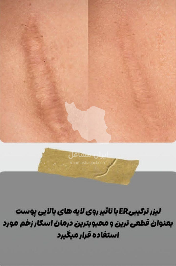 کلینیک تخصصی لیفتینگ و وایتینگ گندم در یزد