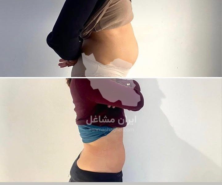 کلینیک تخصصی لیفتینگ و وایتینگ گندم در یزد