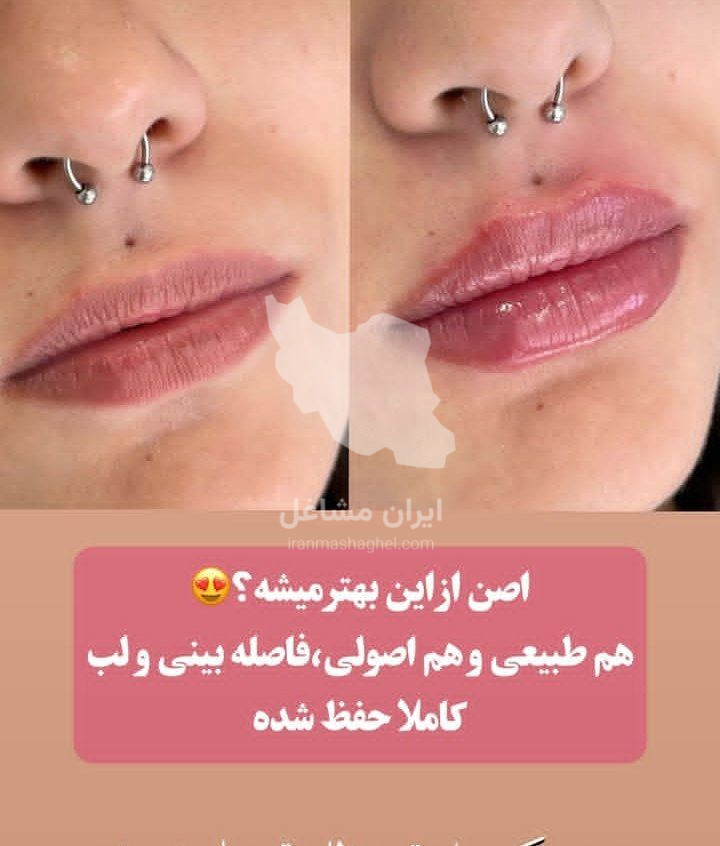 کلینیک تخصصی لیزر موهای زائد گندم در یزد