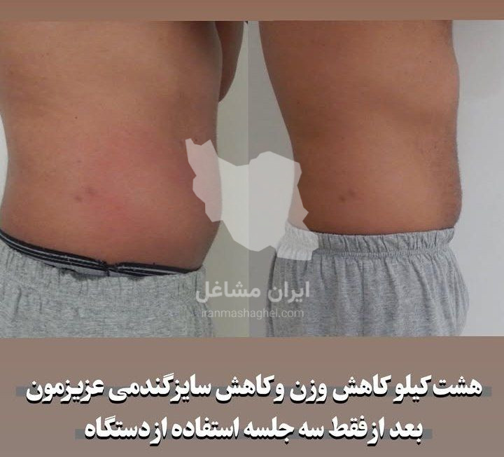 کلینیک کاشت مو گندم در یزد