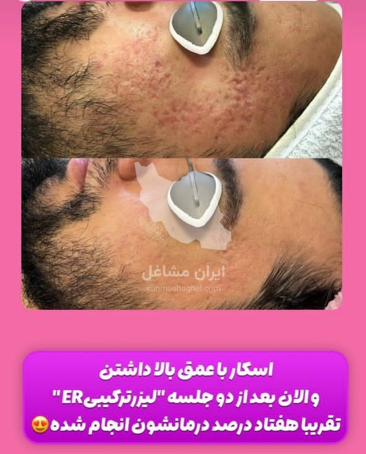 کلینیک کاشت مو گندم در یزد