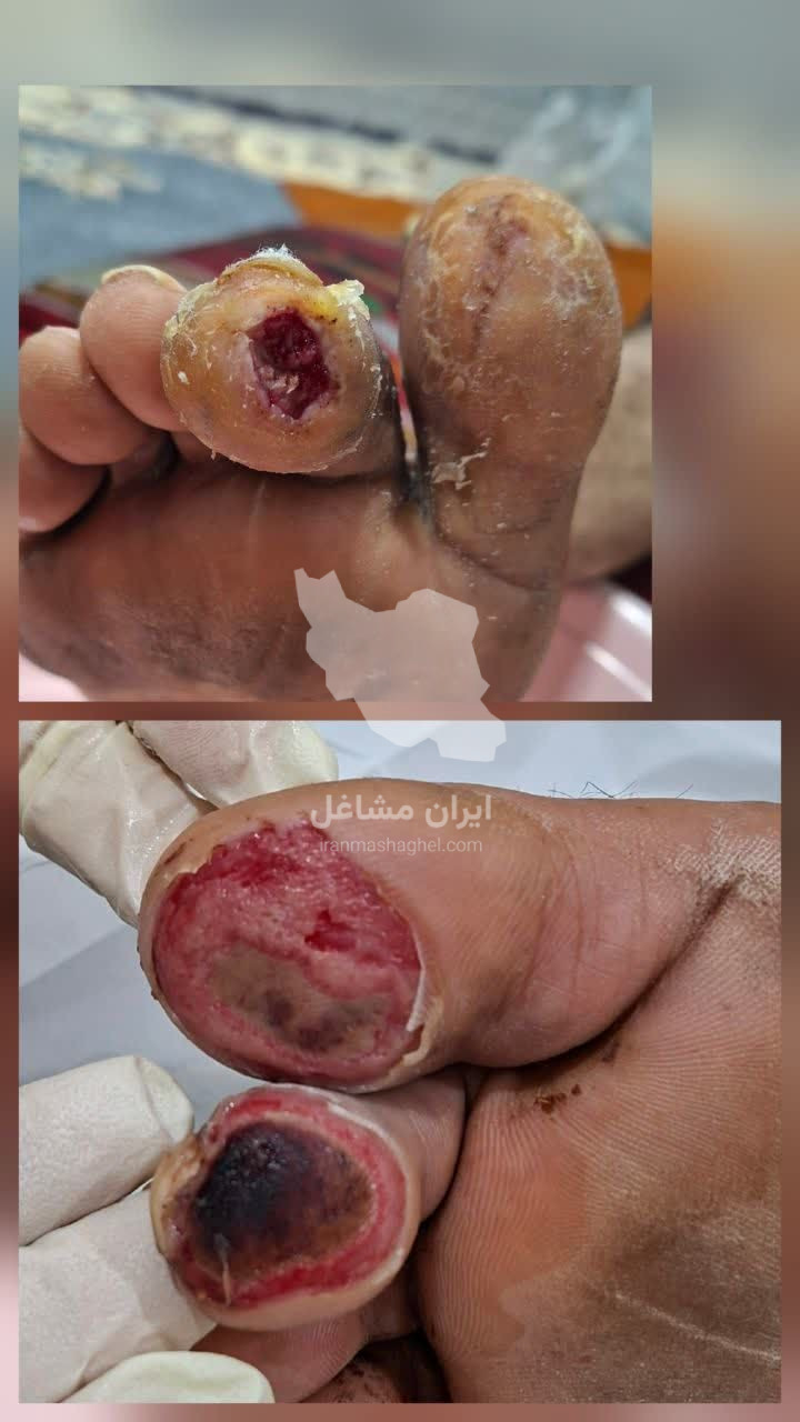 کلینیک و مرکز تخصصی درمان زخم و ترمیم بافت مرهم در ماهشهر