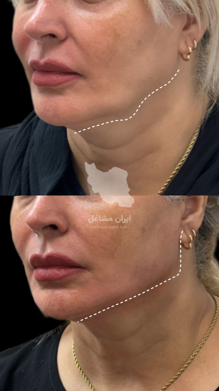 کلینیک زیبایی نینا در قائم شهر
