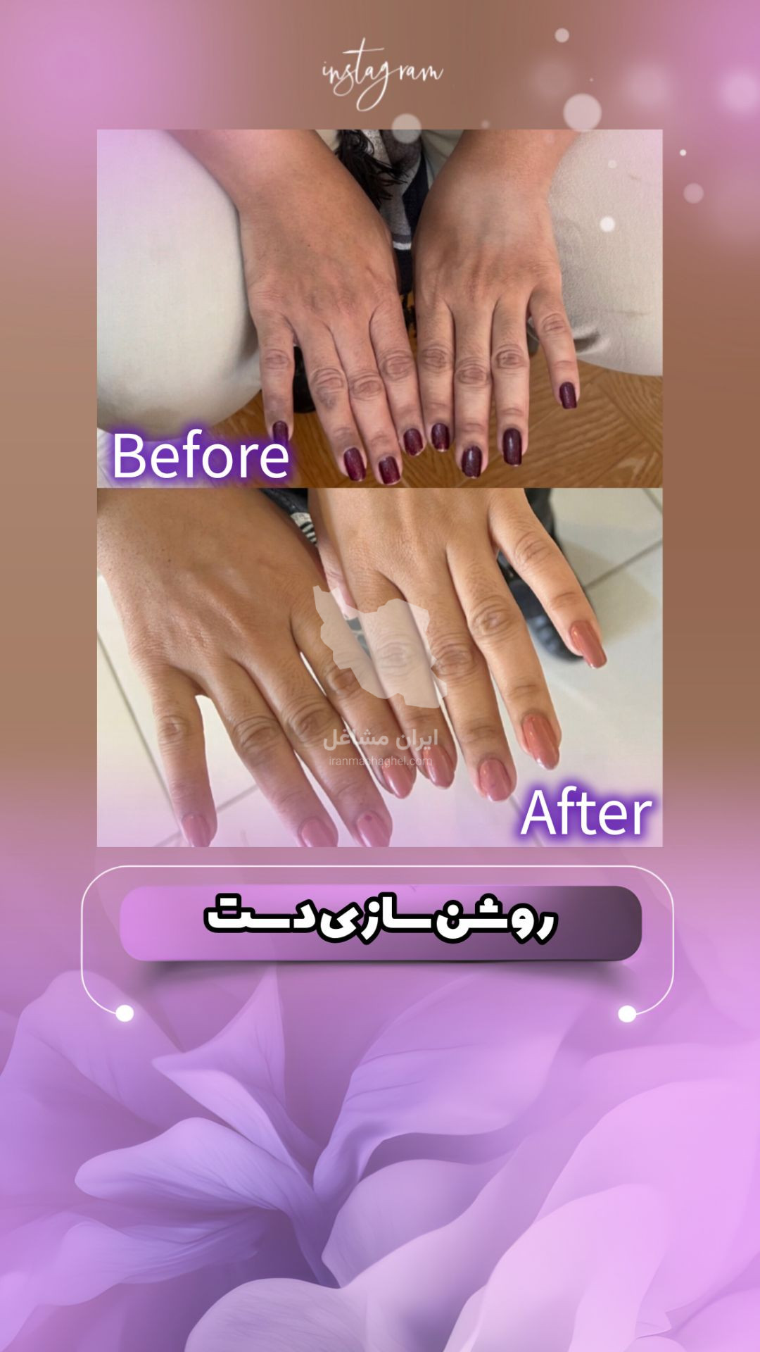 مرکز تخصصی روشن سازی بدن با لیزر نایس قاعدی رفسنجان