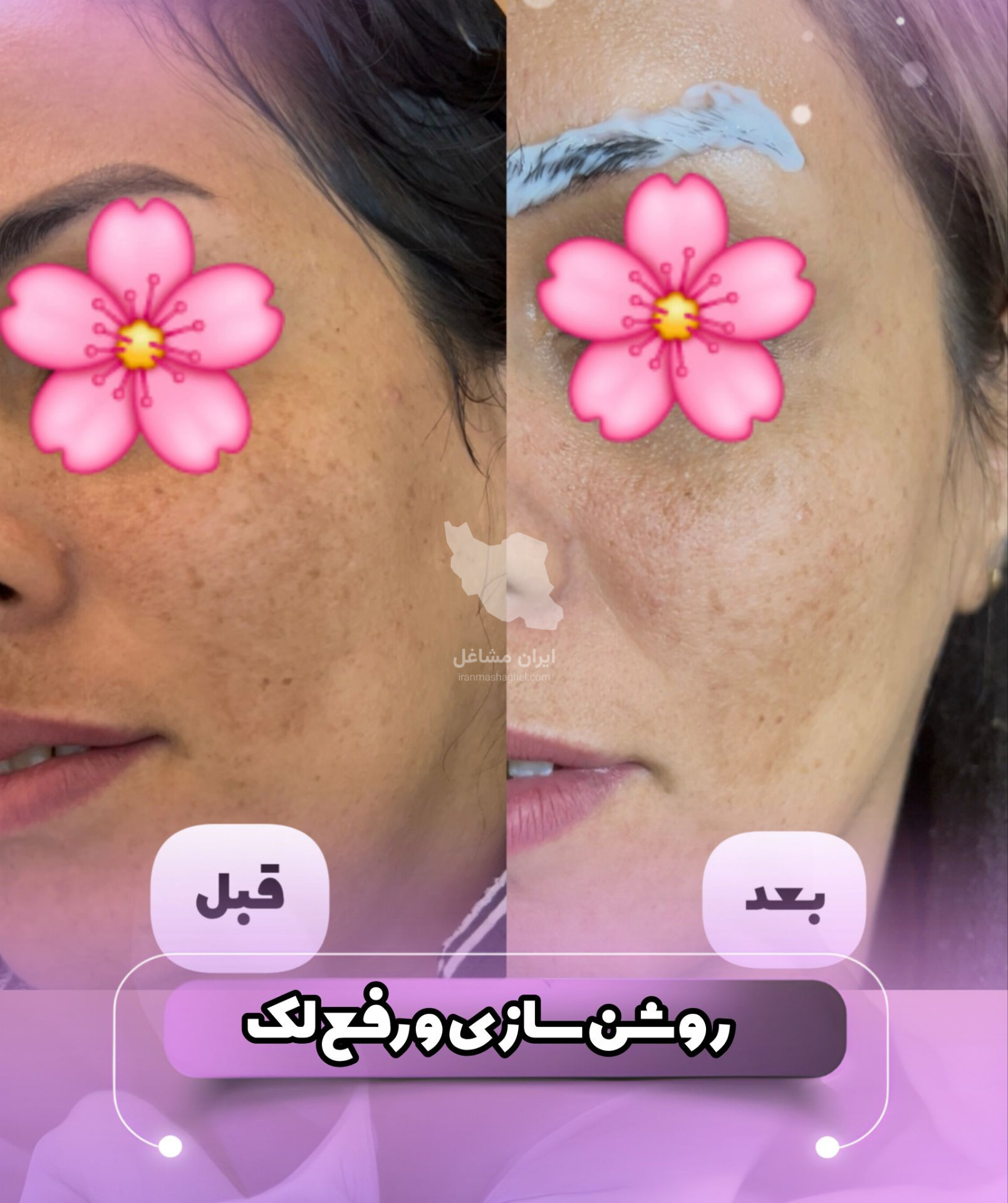 مرکز تخصصی روشن سازی بدن با لیزر نایس قاعدی رفسنجان