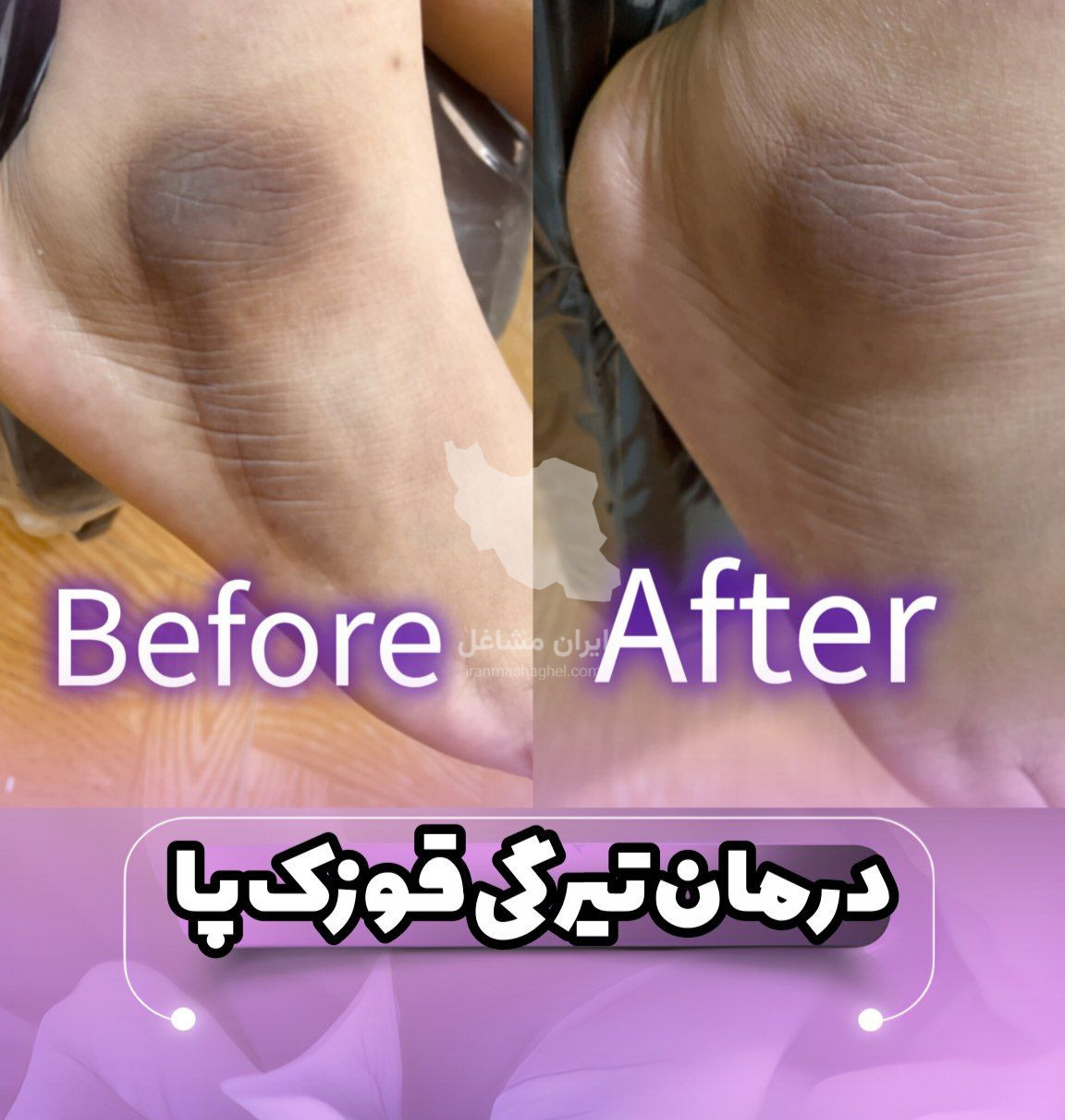 مرکز تخصصی روشن سازی بدن با لیزر نایس قاعدی رفسنجان
