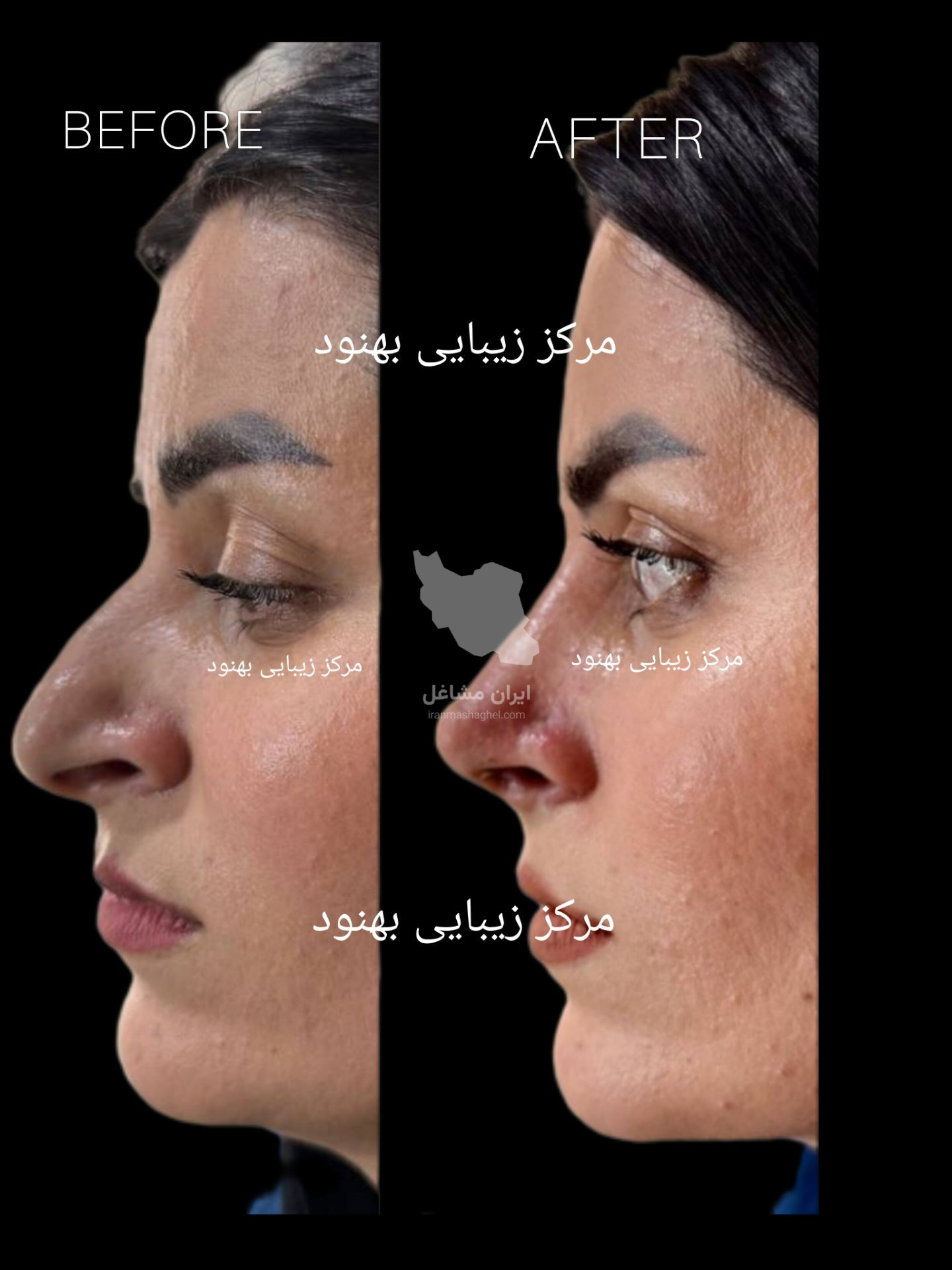 مرکز تخصصی زیبایی بهنود در تبریز