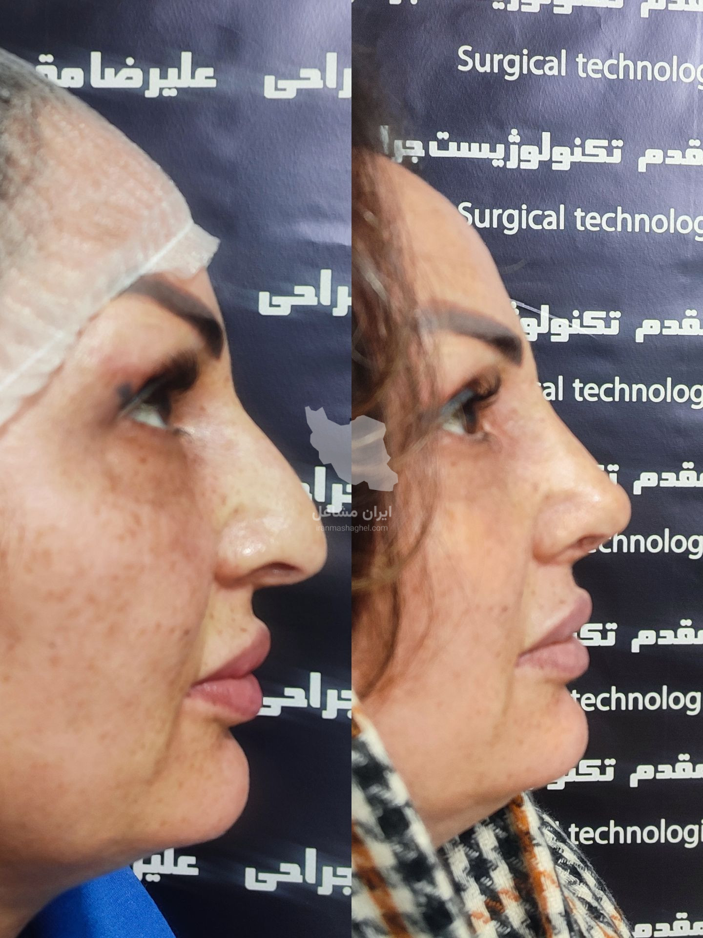 مرکز تخصصی زیبایی بهنود در تبریز