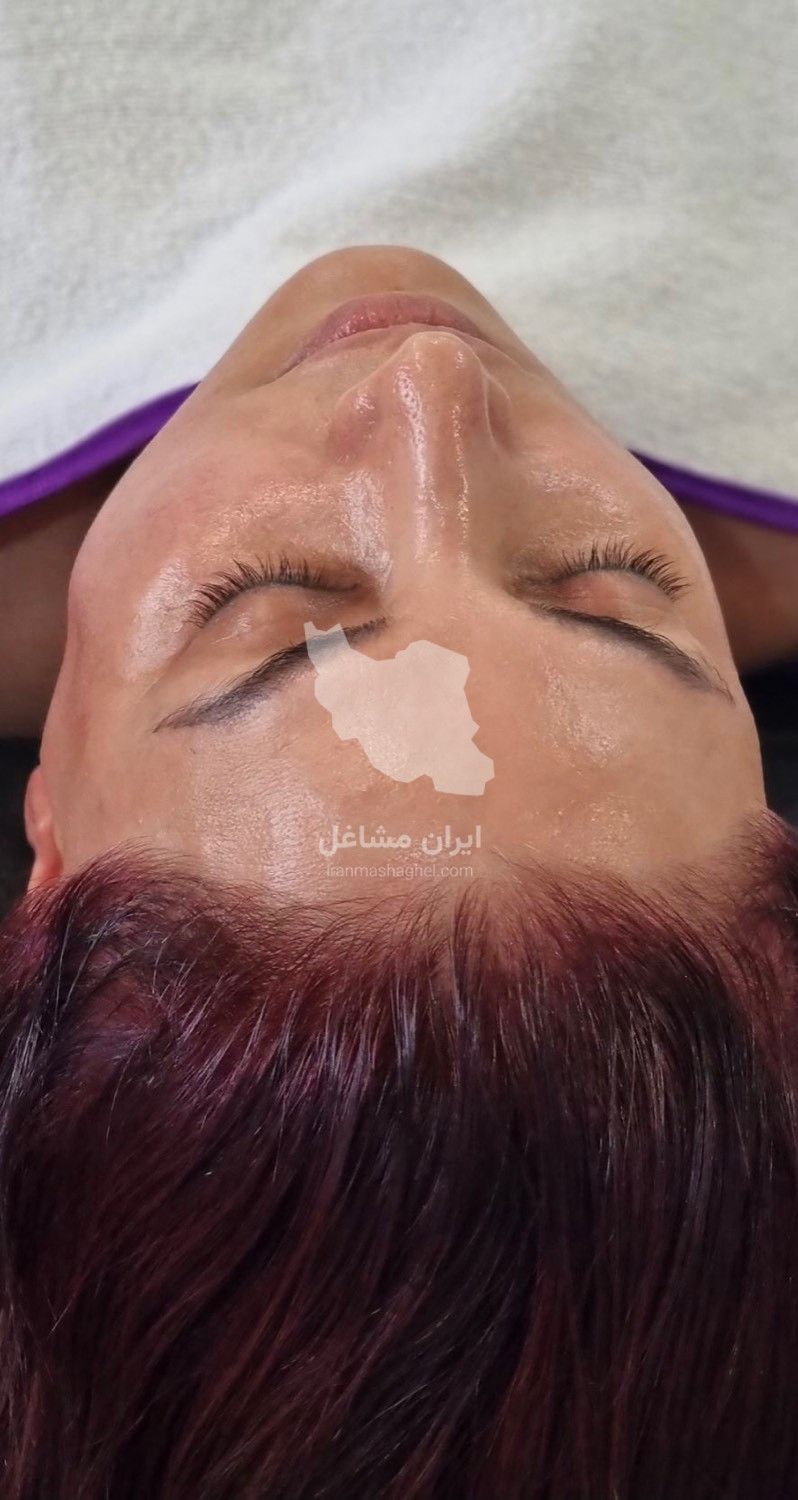خدمات تخصصی فیشال پوست سابل در نوشهر
