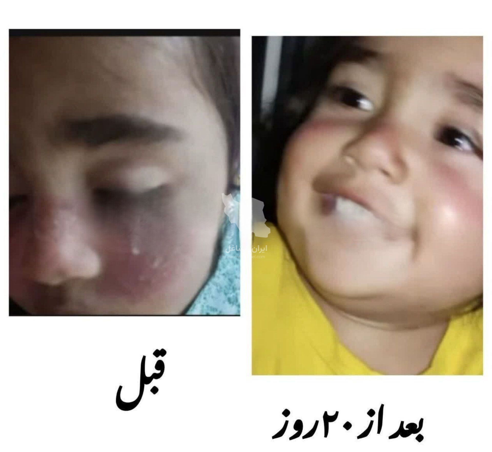 مشاوره و آموزش تخصصی طب سنتی لیلا محمدی در پرند