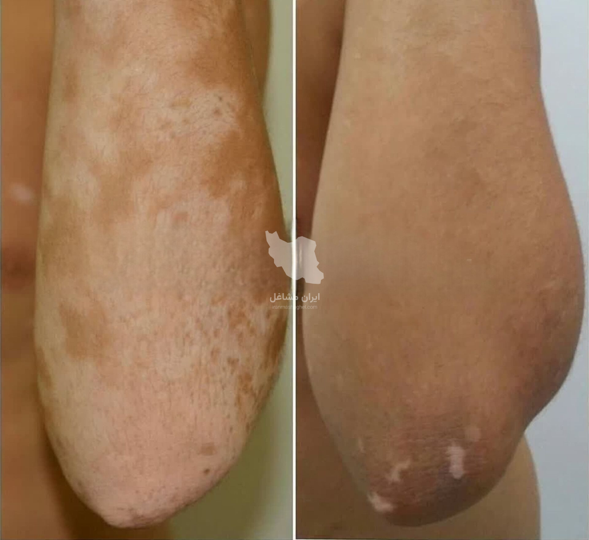 مشاوره و آموزش تخصصی طب سنتی لیلا محمدی در پرند