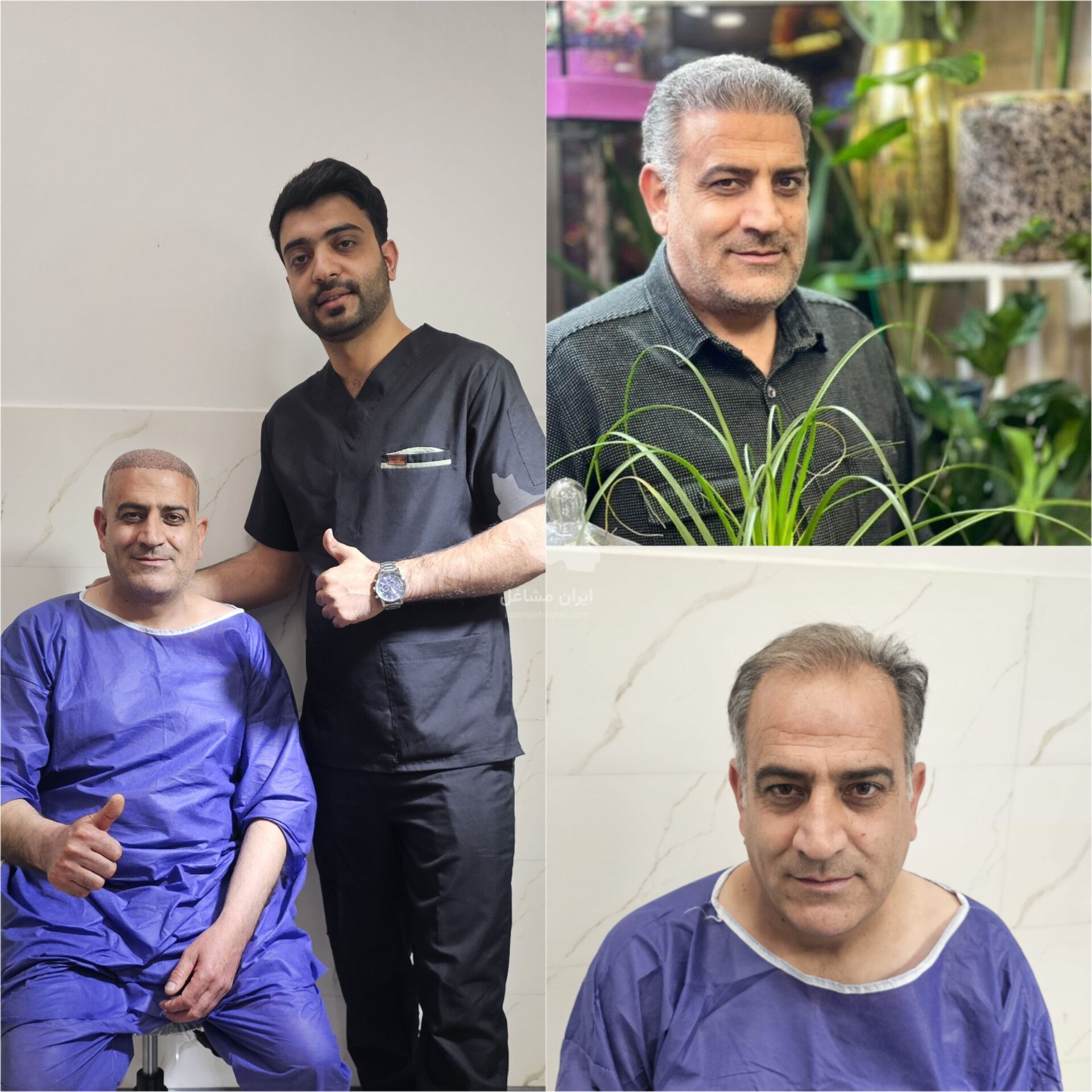 مرکز تخصصی کاشت مو و ابرو احمدیه اژکان در تربت حیدریه