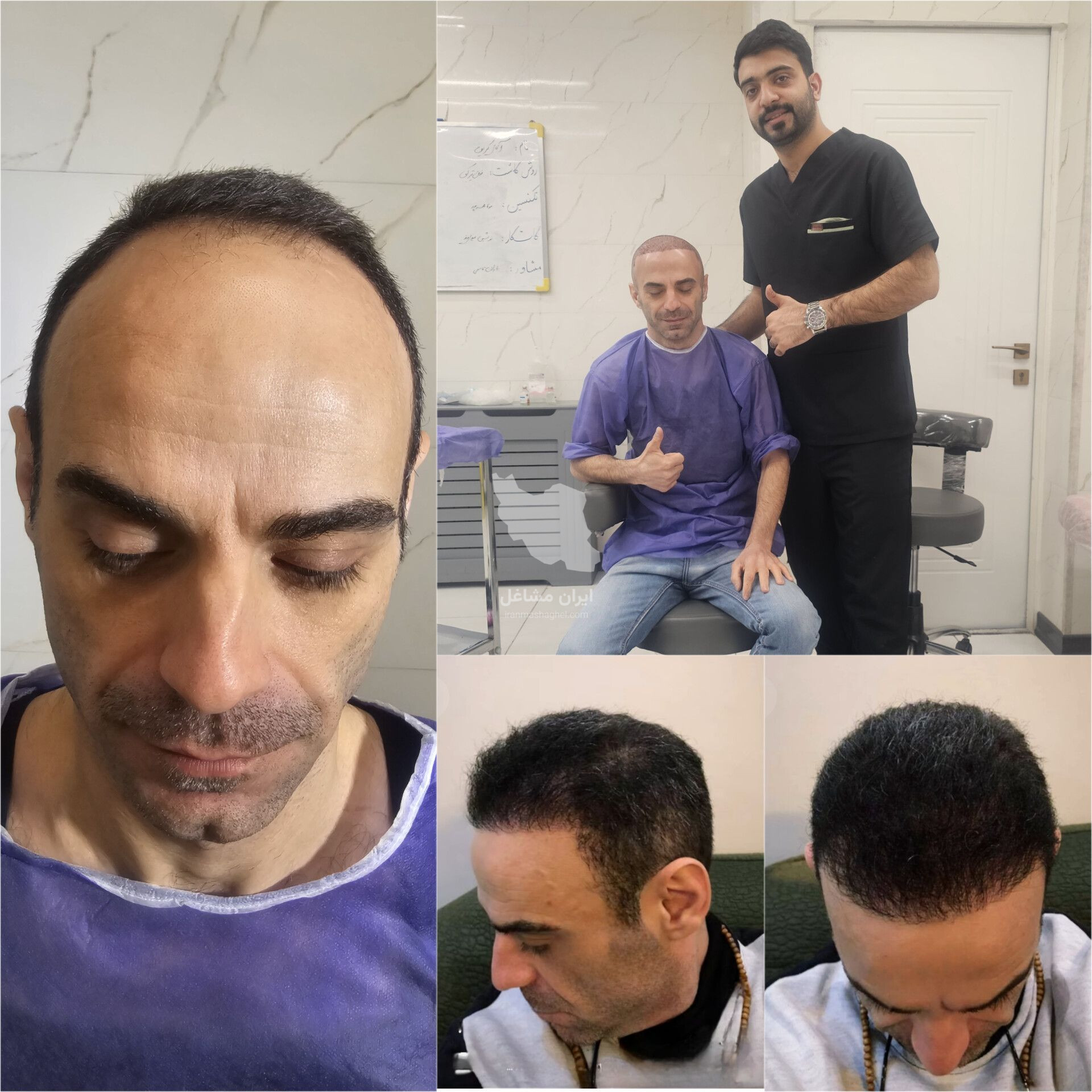مرکز تخصصی کاشت مو و ابرو احمدیه اژکان در تربت حیدریه