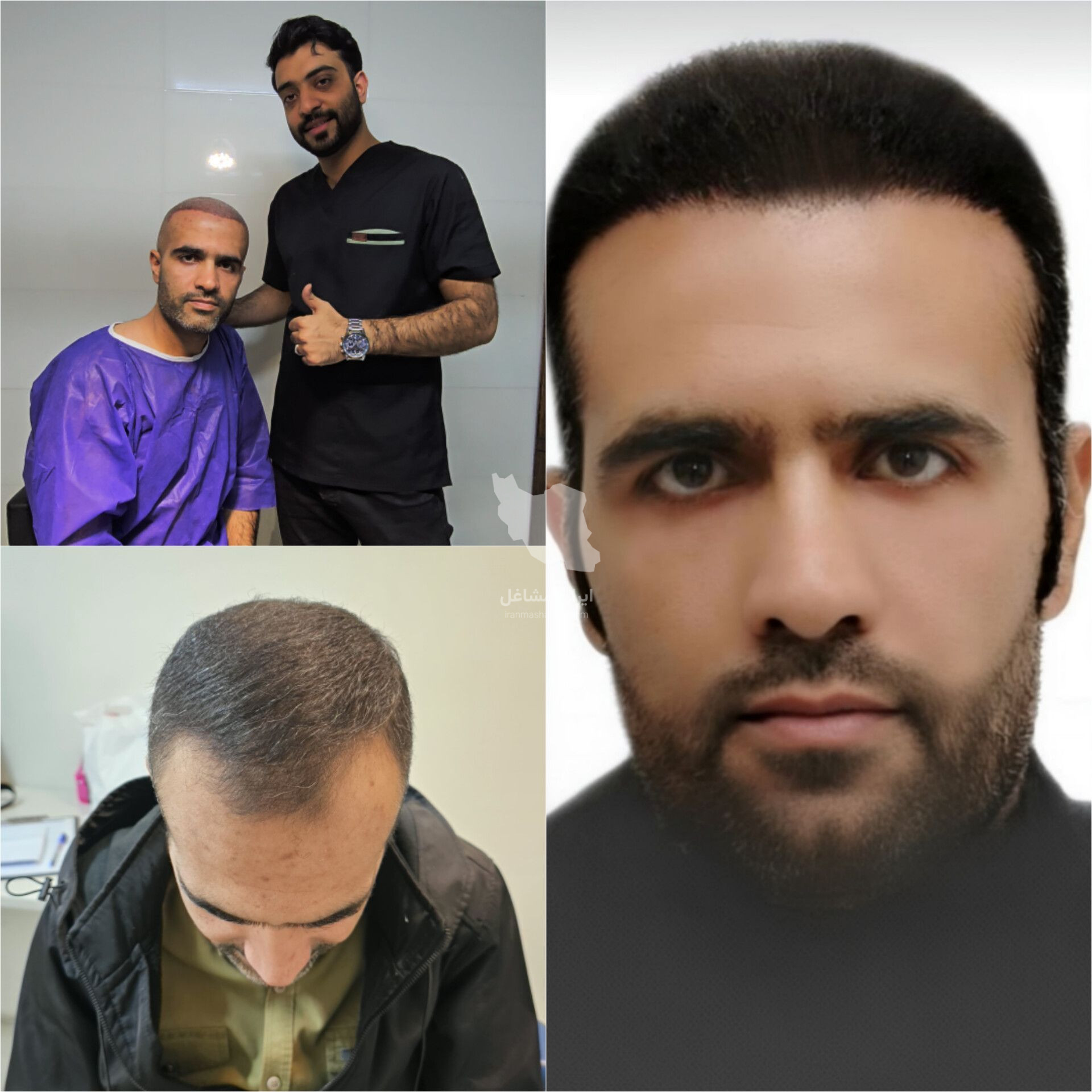 مرکز تخصصی کاشت مو و ابرو احمدیه اژکان در تربت حیدریه