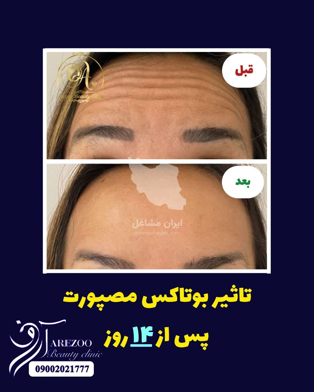 کلینیک زیبایی آرزو در سه راه پلنگ صورتی بندرعباس