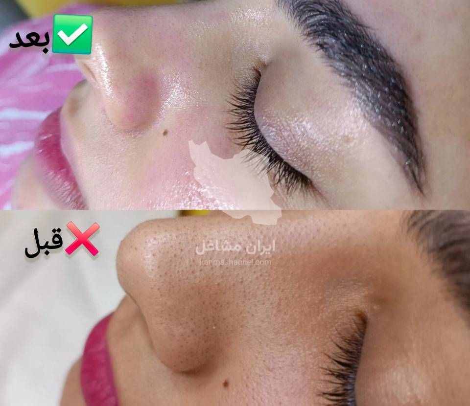 آموزش فیشیال و جوانسازی پوست به مدیریت خانم سحر پیکر در بهبهان