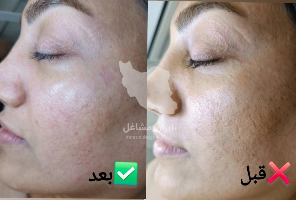 آموزش فیشیال و جوانسازی پوست به مدیریت خانم سحر پیکر در بهبهان