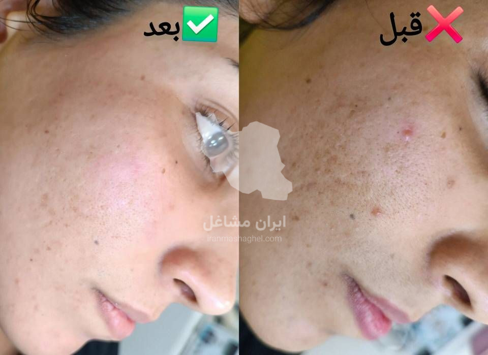آموزش فیشیال و جوانسازی پوست به مدیریت خانم سحر پیکر در بهبهان