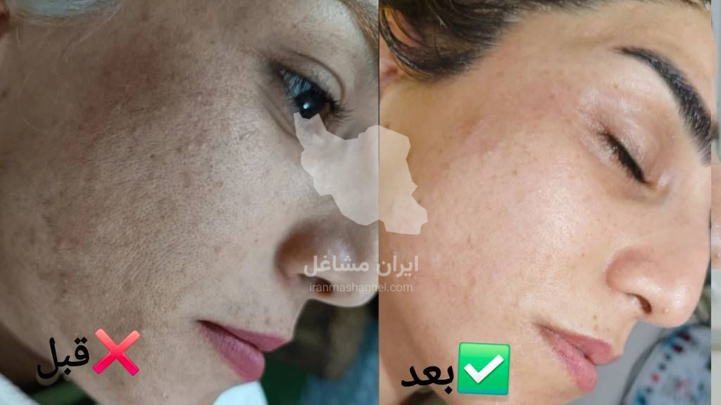 آموزش فیشیال و جوانسازی پوست به مدیریت خانم سحر پیکر در بهبهان
