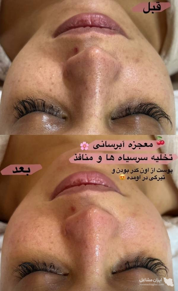 آکادمی تخصصی و درمانی فیشیال مینا خلیلی در قم