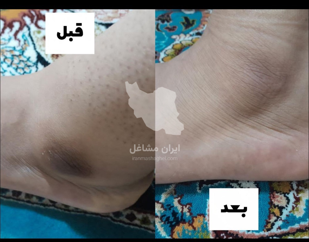 مرکز تخصصی لیزر نایس خانم قاعدی در رفسنجان