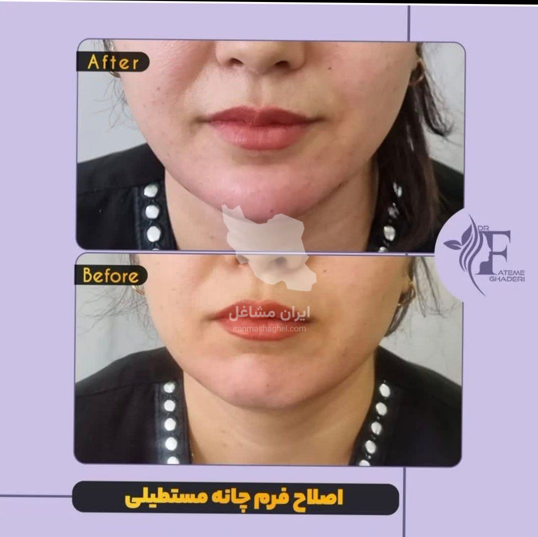 مطب زیبایی پوست و مو دکتر فاطمه قادری در صدرا