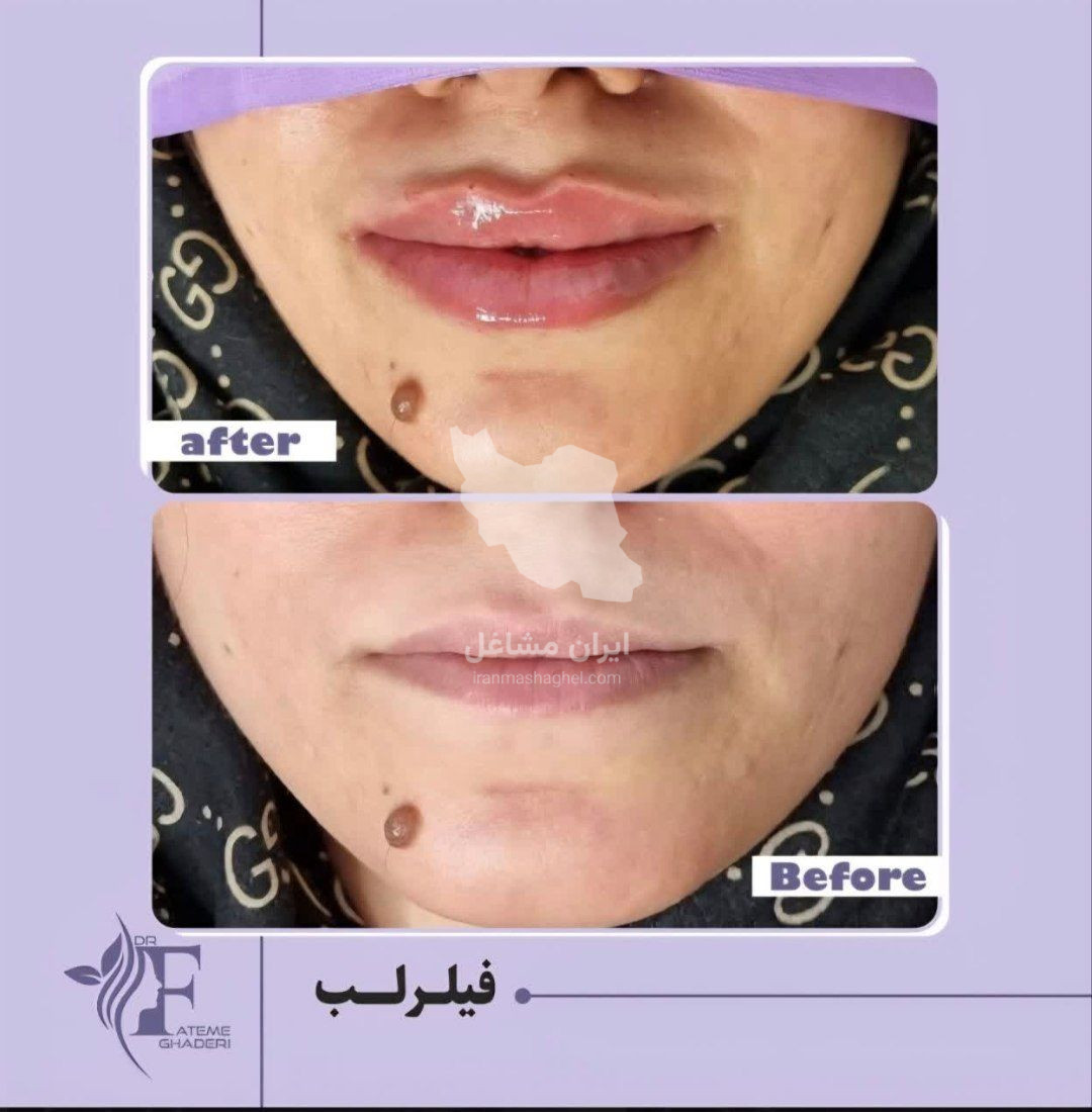 مطب زیبایی پوست و مو دکتر فاطمه قادری در صدرا