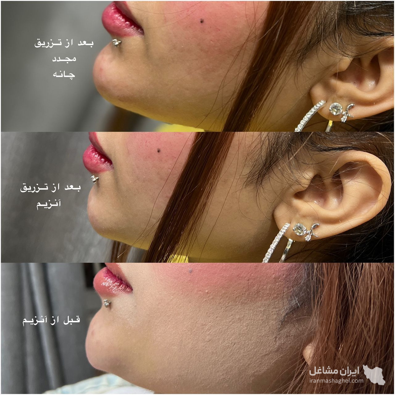 مطب زیبایی دکتر فاطمه موسوی در برازجان
