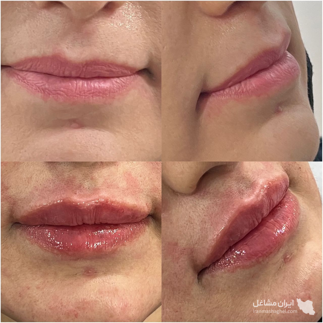 مطب زیبایی دکتر فاطمه موسوی در برازجان