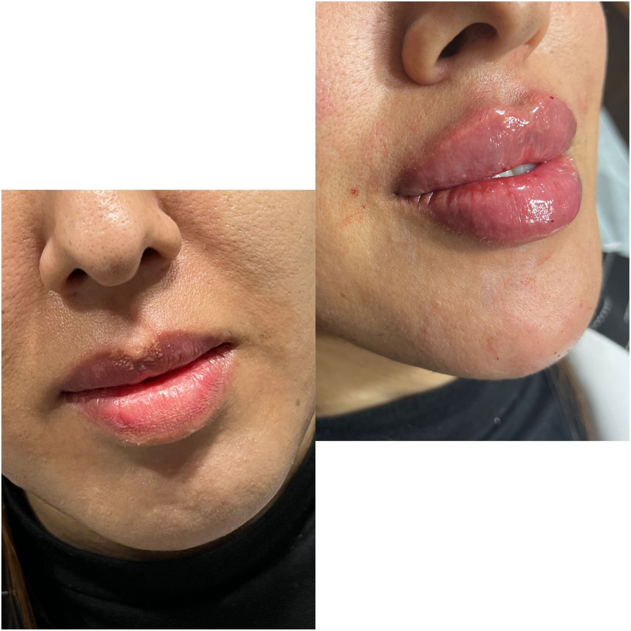 مطب زیبایی دکتر فاطمه موسوی در برازجان